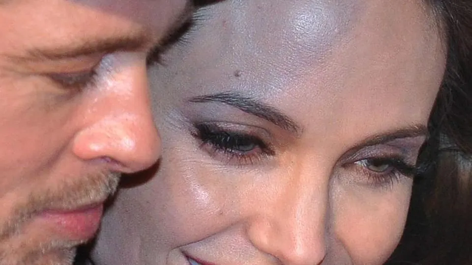 rughe del sorriso