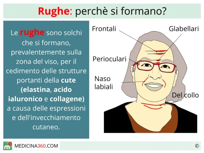 Rughe viso: come si formano e rimedi naturali