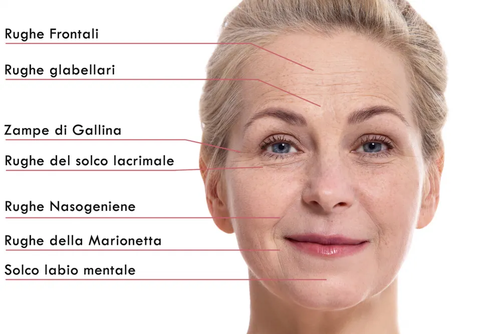 quali sono le cause della comparsa delle rughe sul viso