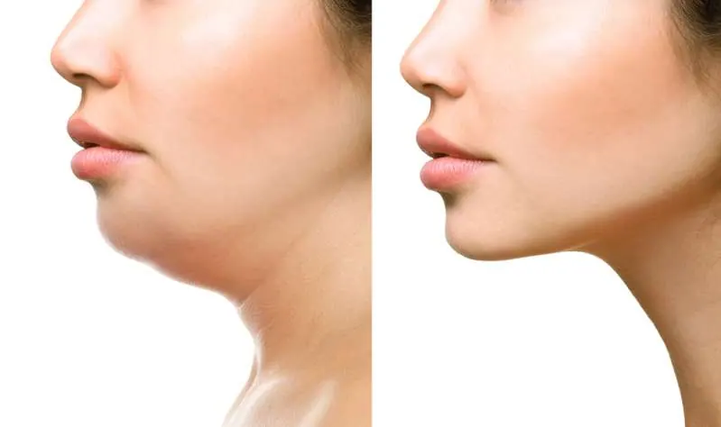 quali sono gli esercizi per rassodare il collo