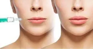 Due volti di donna con l'uso del filler