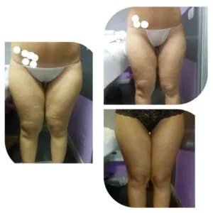 Gambe di donna
