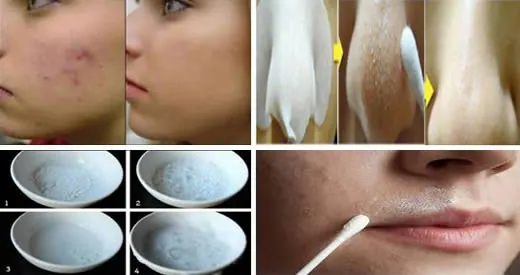 Pulizia del viso con la maschera al bicarbonato: come fare