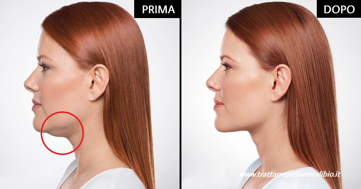 esercizi per eliminare il doppio mento