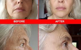 face yoga