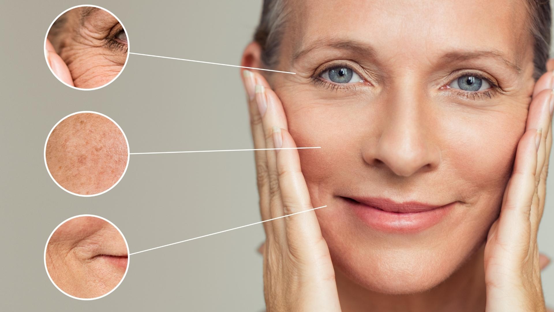 come prevenire la comparsa di rughe sul viso